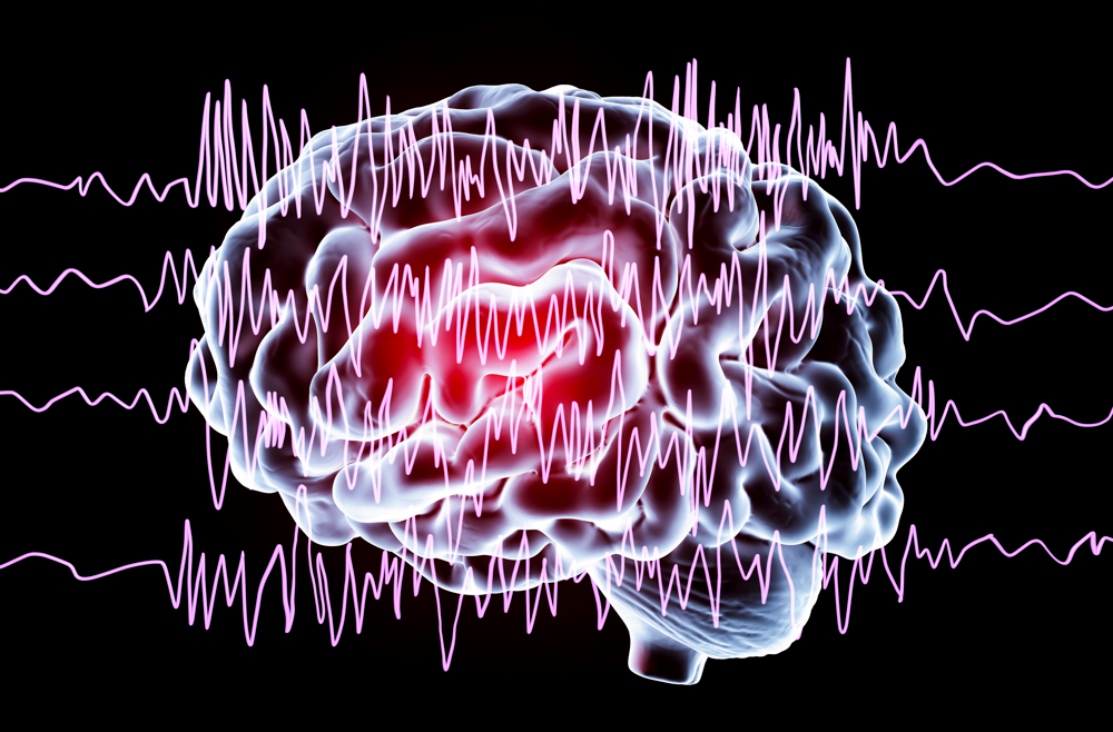 A digital illustration of an outline of a brain with brain waves across it.